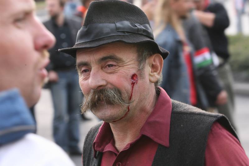 Közeli portré a tüntetőről, vérző sebbel az arcán.